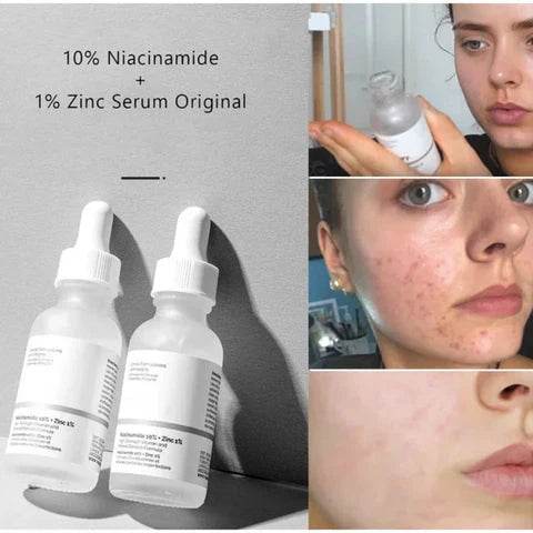 The Ordinary Niacinamide 10% + Zinc 1% Serum - Vora