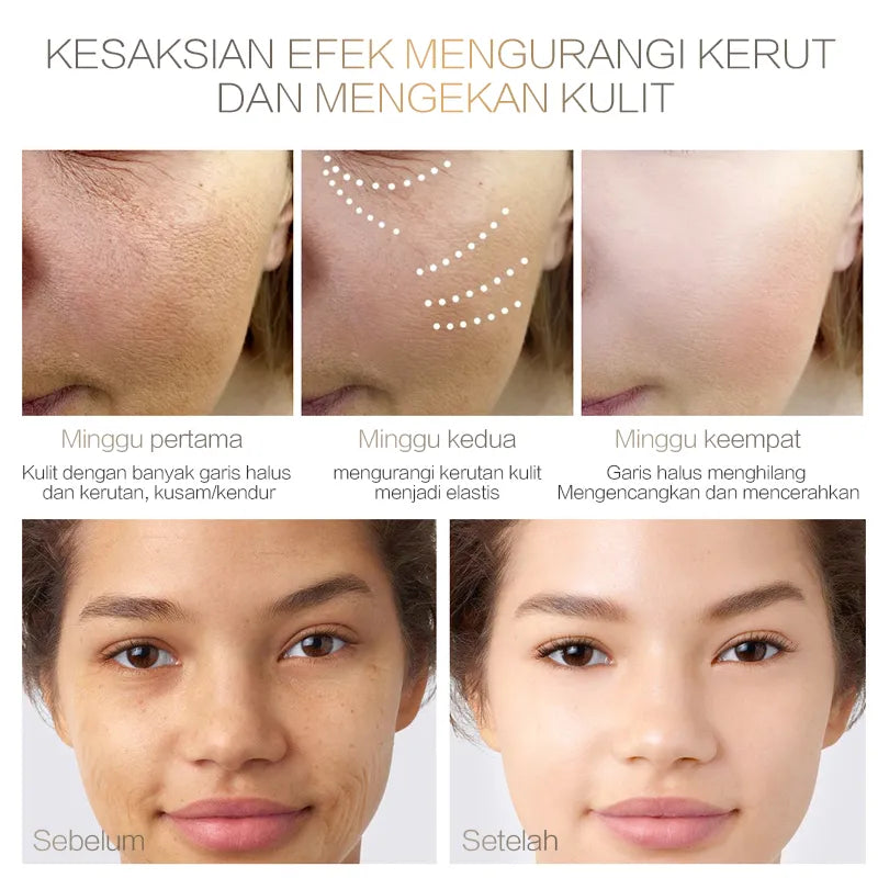 Chalonese Brightening Cream- Buy 1 Get 1 Free