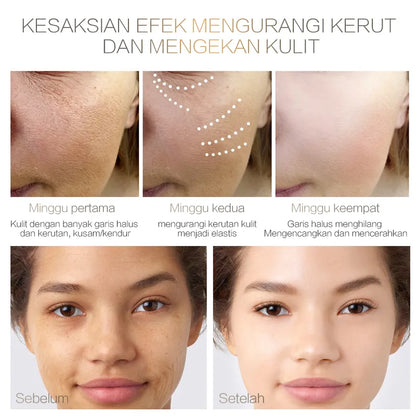 Chalonese Brightening Cream- Buy 1 Get 1 Free