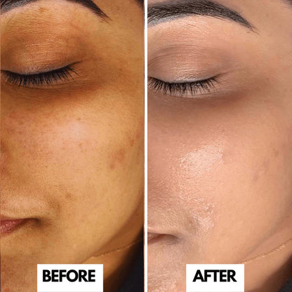 O3+ Professional Bridal Facial Kit - Single Use Vitamin-C Glowing Skin Treatment