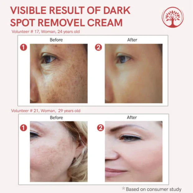 Celimax Whitening Cream - Reduce Dark Spots & Pigmentation | Minimize Open Pores