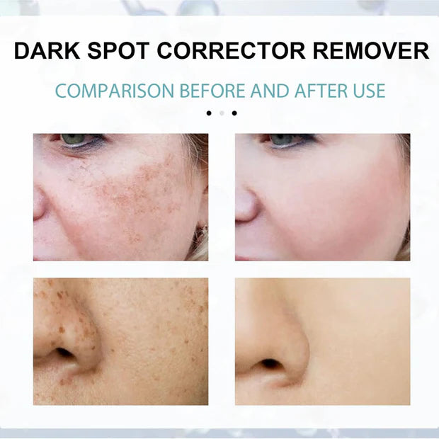 Celimax Whitening Cream - Reduce Dark Spots & Pigmentation | Minimize Open Pores