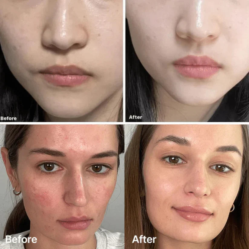 Medicube Deep Vita C Capsule Cream | Customizable Brightening & Hydration Cream for Dark Spots & Dullness