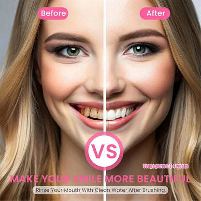 Niacinamide Whitening Toothpaste