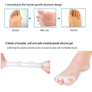 Pro Sports Silicone Toe Separators - Free Size (1 Pair)