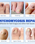 Nighttime Renewal Fungal Nail Patches