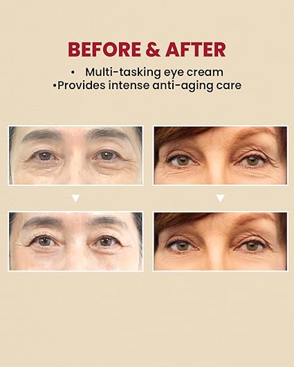 K-Secret Seoul 1988 Eye Cream Retinal Liposome 4% + Fermented Bean 30ml - Made In Korea