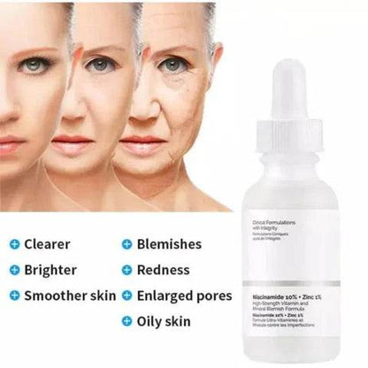 The Ordinary Niacinamide 10% + Zinc 1% Serum - Vora