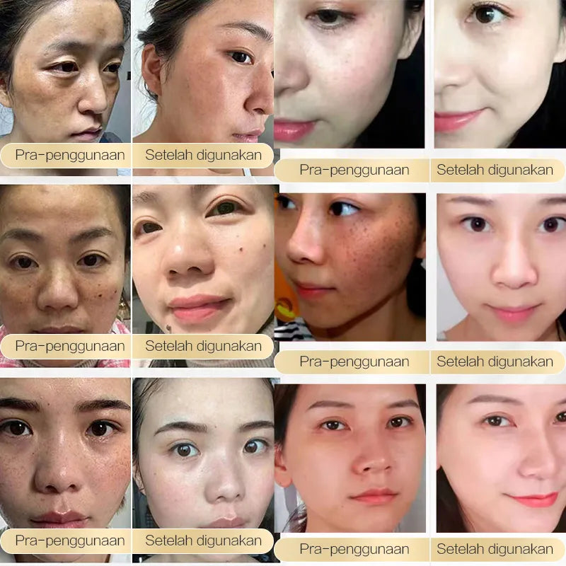 Chalonese Brightening Cream- Buy 1 Get 1 Free