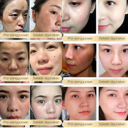 Chalonese Brightening Cream- Buy 1 Get 1 Free