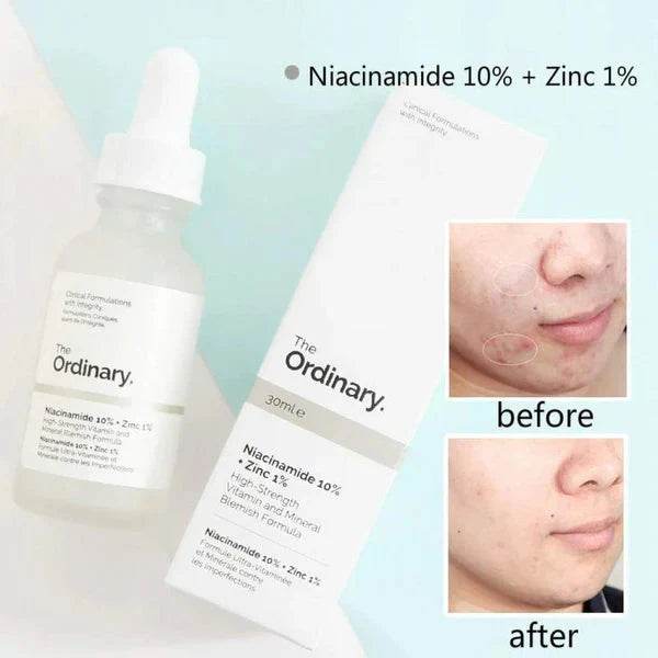The Ordinary Niacinamide 10% + Zinc 1% Serum - Vora